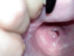 'Cervix close up [4k]'